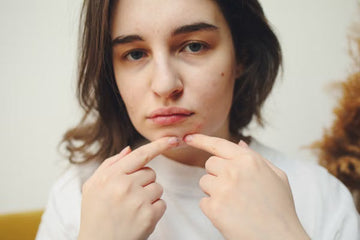 Close-up of a woman with acne touching her cheek